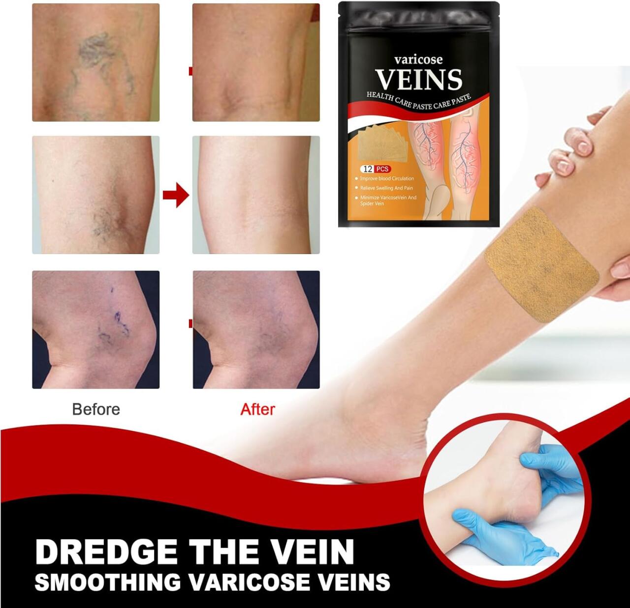 Parches Para El Cuidado De Las Venas 36 unidades